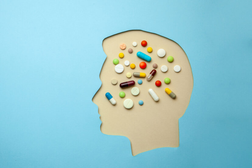 Brain supplements